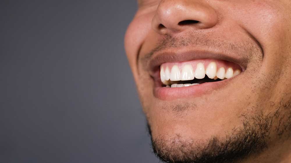 a patient smiling after his LANAP gum disease treatment