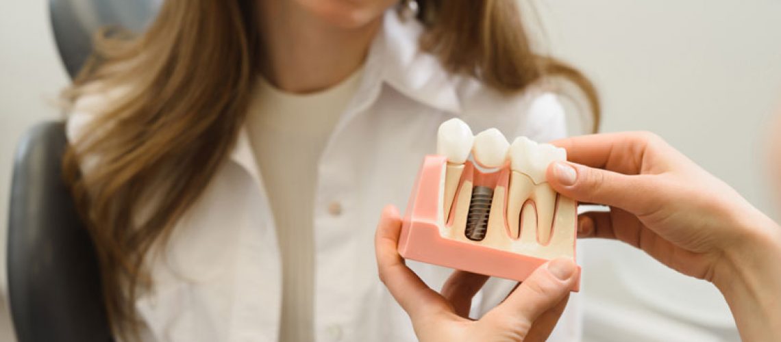 Dental Patient Getting Shown A Dental Implant Model During Her Consultation in Miami, FL