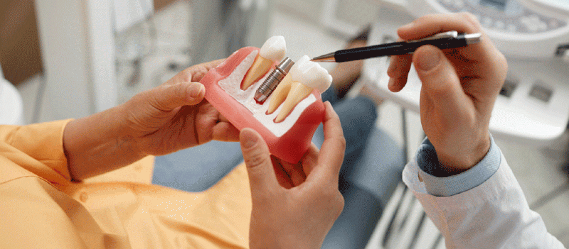 Woman holding tooth model during consultation on dental implant